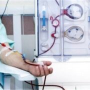 پرتودهی هسته‌ای 1.3 میلیون فیلتر دیالیز بدون هیچ‌گونه عارضه