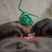 آخرین آمار‌ها مصدومان چهارشنبه سوری اعلام شد