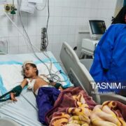 36 مجروح حمله آمریکا به سیریک از بیمارستان ترخیص شده‌اند